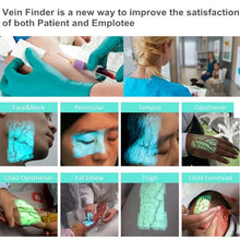 Load image into Gallery viewer, Medical Vein Finder Device
